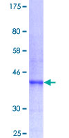 12.5% SDS-PAGE Stained with Coomassie Blue.